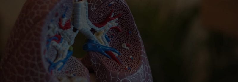 close-up of lungs depicting mesothelioma