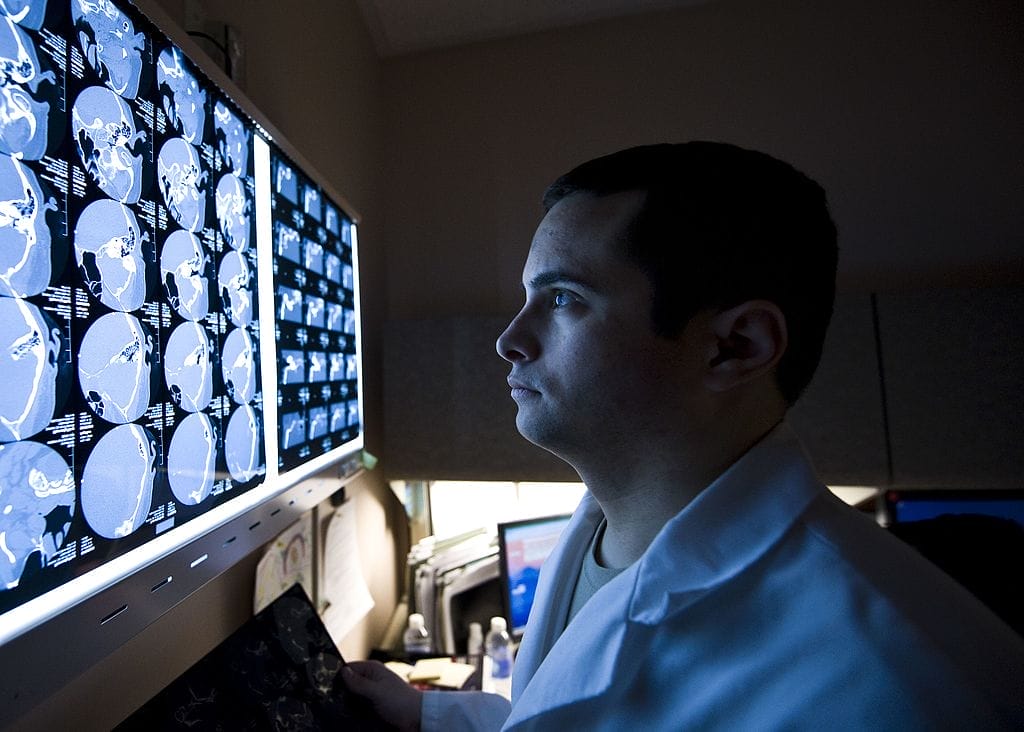 doctor reviewing CT scans of patient with a traumatic brain injury